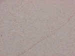 "Pink Sand" - pieces of shell, coral, and calcium carbonate